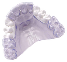 Phase 1 Clear Replacement Retainers